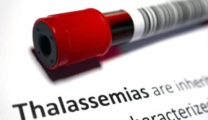 Genetic Testing for Thalassemia Reducing the Burden of Inherited Diseases