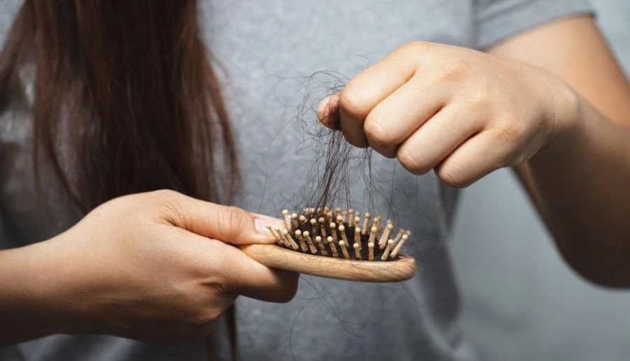 Genetics in Hair Loss