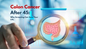 Colon Cancer After 45- Why Screening Can Save Your Life