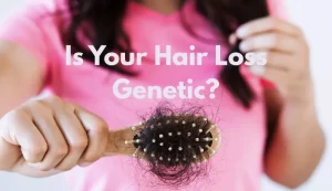Is Your Hair Loss Genetic Understanding the Real Cause